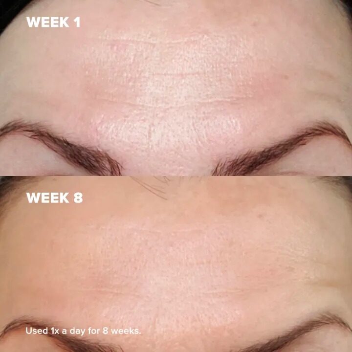 Exfoliate & Grow: 2 x 2% BHA Exfoliant 30ml