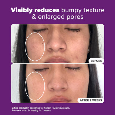 Niacinamide 20% Treatment - Paula's Choice Malaysia
